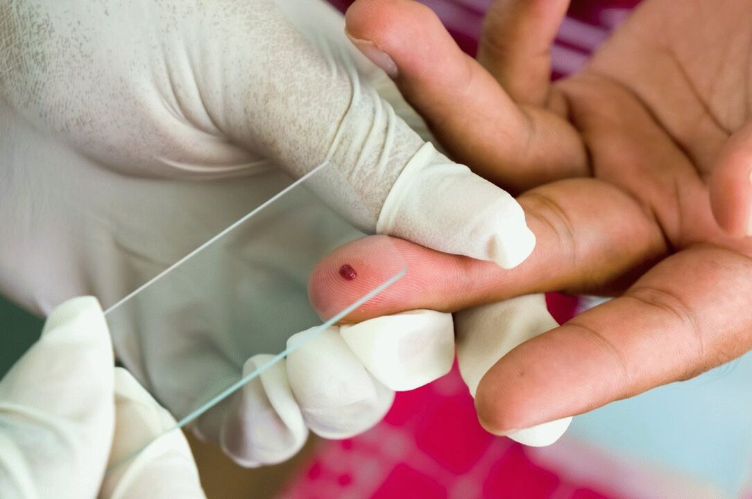 Blood test from the finger