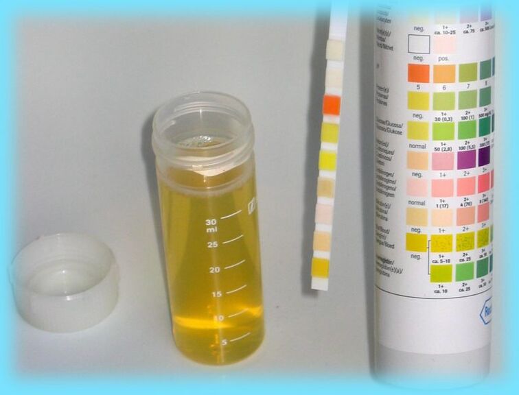 Urinary analysis